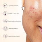 Acne Control Gel 50 gm For Clear, Healthy Skin