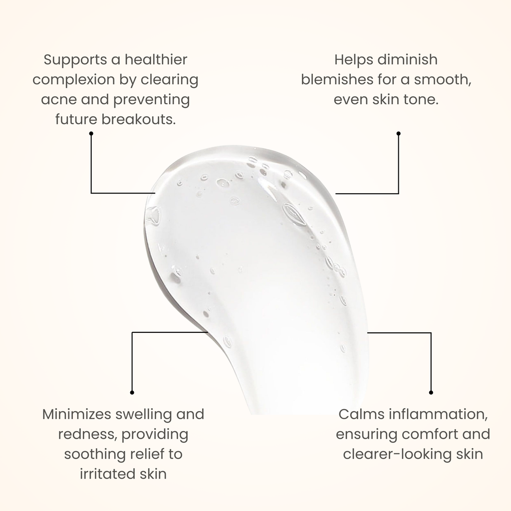 Acne Control Gel 50 gm For Clear, Healthy Skin