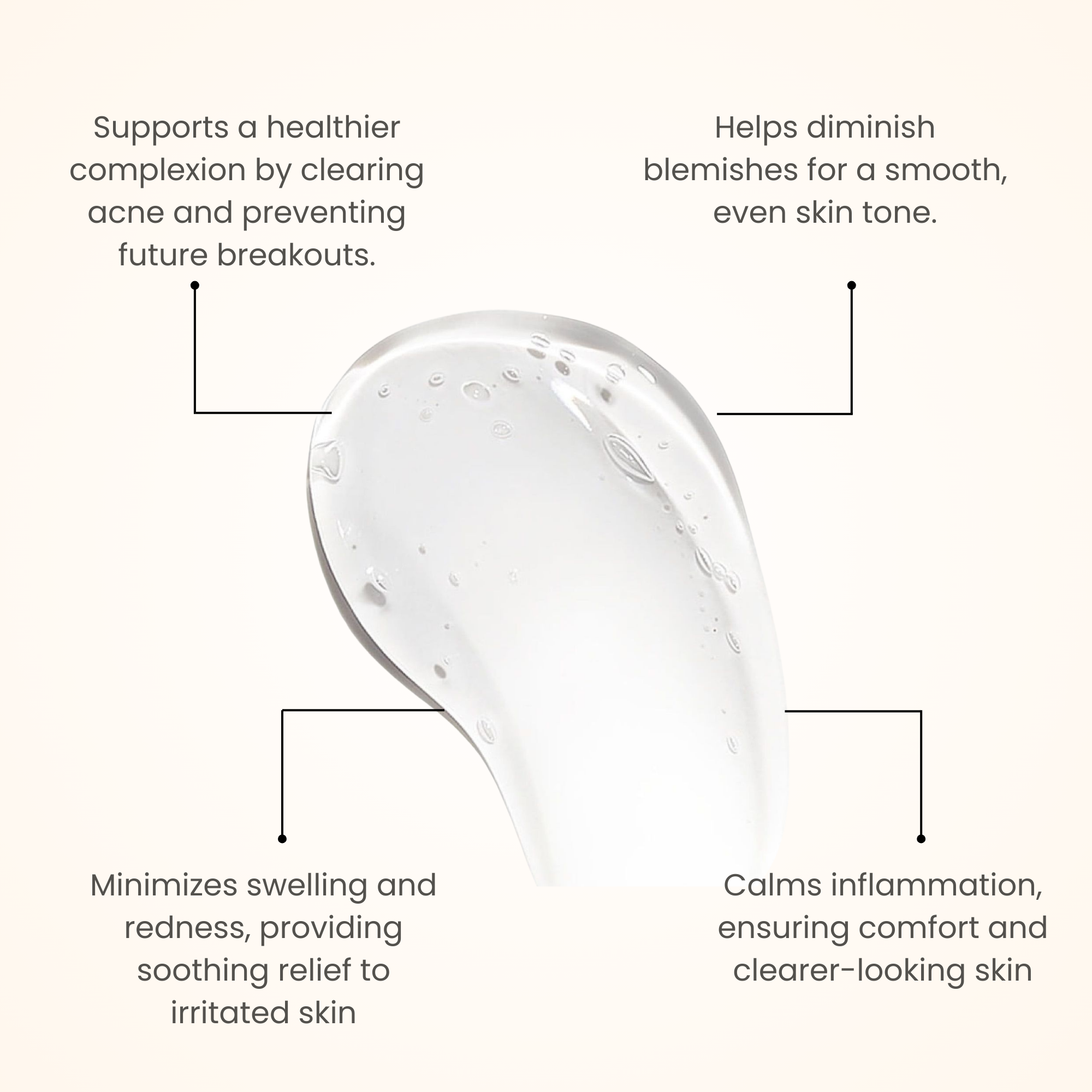 Acne Control Gel 50 gm For Clear, Healthy Skin